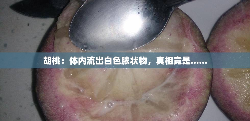 胡桃：体内流出白色脓状物，真相竟是......