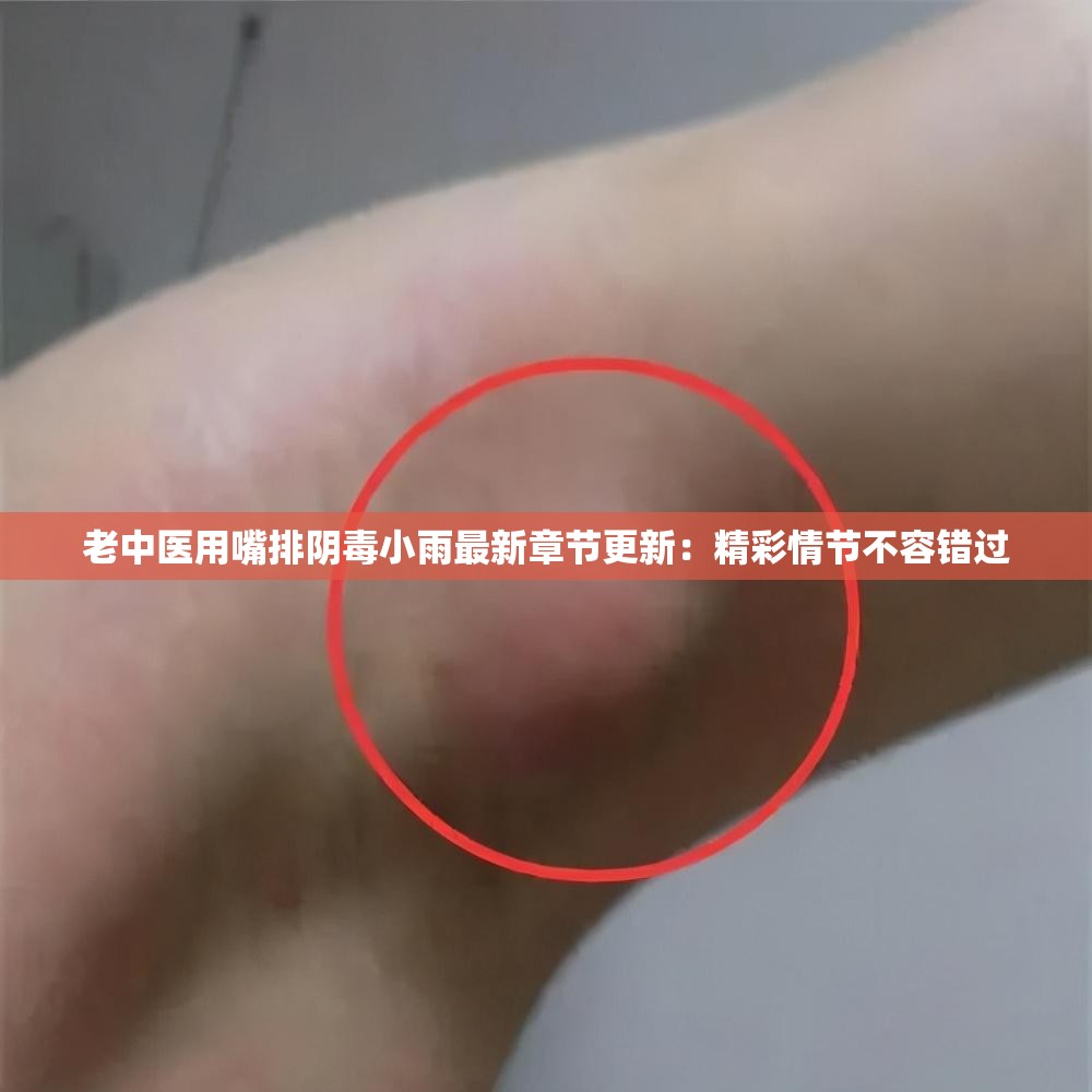 老中医用嘴排阴毒小雨最新章节更新：精彩情节不容错过