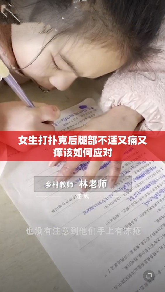 女生打扑克后腿部不适又痛又痒该如何应对