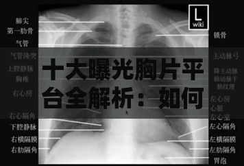 十大曝光胸片平台全解析：如何选择最适合您的医疗影像服务平台？